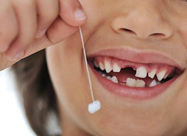 Existe forma correta de extrair dente de leite? Entenda