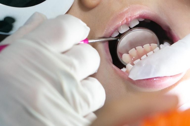 Projeto em Brasília oferece tratamento odontológico gratuito para crianças e adolescentes em situação de vulnerabilidade