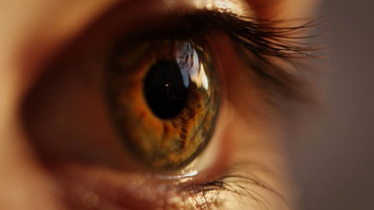 “Caspa” nos cílios? Descamação pode ser sinal de inflamação nos olhos