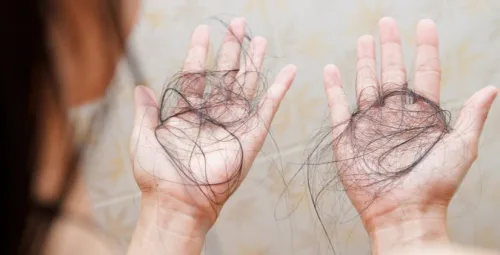 alimentos queda de cabelo